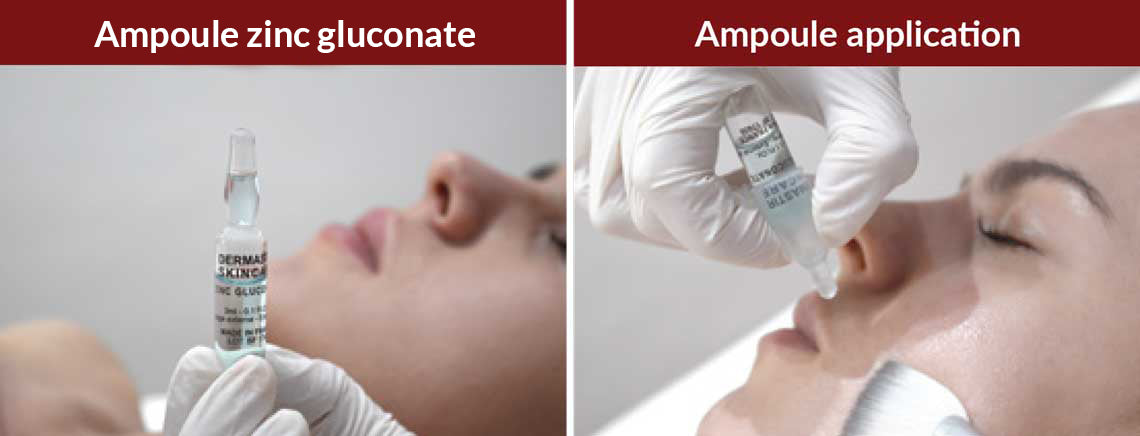Dermastir Zinc Gluconate Ampoules